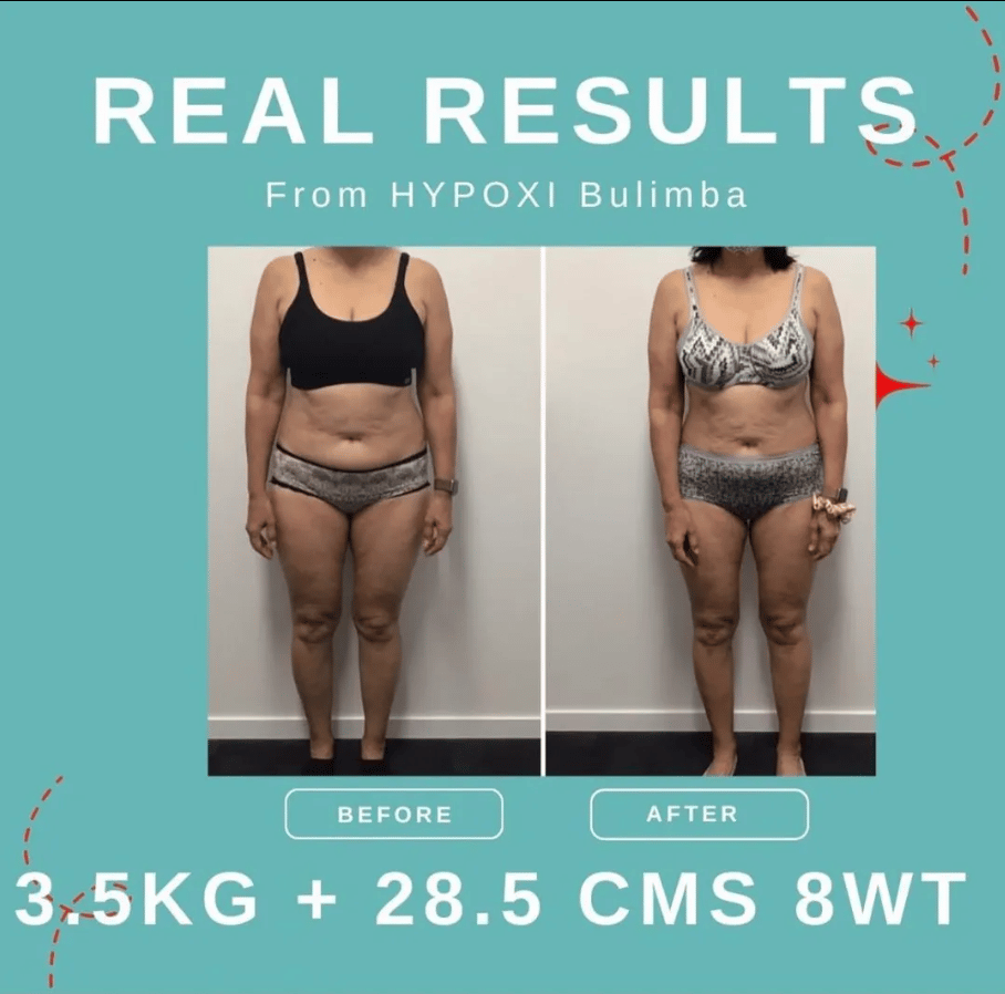 Hypoxi Bulimba | Real Results Hypoxi